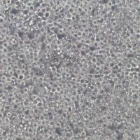 NB4细胞系、NB4细胞、NB4急性早幼粒白血病细胞