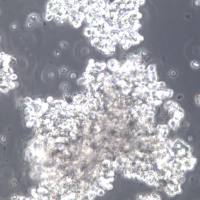 NCI-H209细胞株、NCI-H209细胞、NCI-H209小细胞肺癌细胞