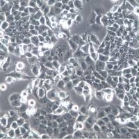 NCI-H2087细胞株、NCI-H2087细胞、NCI-H2087非小细胞肺腺癌细胞