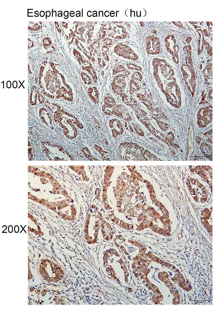 K114159P Anti-DNAJA1 Polyclona