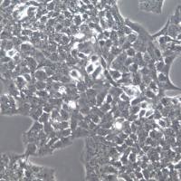 JHH-7细胞株、JHH-7细胞、JHH-7肝癌细胞