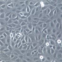 NCI-H1650细胞系、NCI-H1650细胞、NCI-H1650非小细胞肺癌细胞