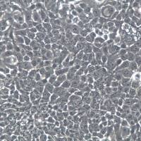 Kyse-150细胞系、Kyse-150细胞、Kyse-150食管癌细胞