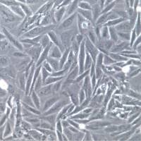 Saos-2细胞系、Saos-2细胞、Saos-2成骨肉瘤细胞