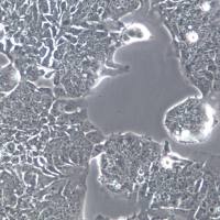 T84 细胞系、T84 细胞、T84 结直肠癌细胞  