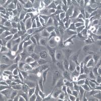 NCI-H2009细胞系、NCI-H2009细胞、NCI-H2009肺腺癌细胞