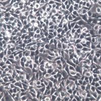 RD细胞、RD细胞系、RD恶性胚胎横纹肌肉瘤细胞