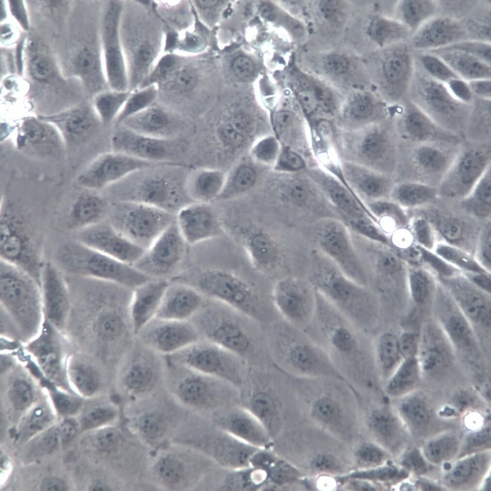 SNU-216细胞系、SNU-216细胞、SNU-216胃癌细胞