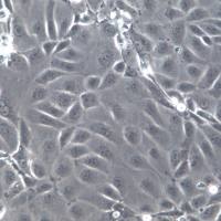 SNU-216细胞系、SNU-216细胞、SNU-216胃癌细胞