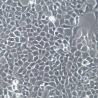 HTR-8细胞、HTR-8 、HTR8