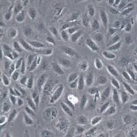 TPC-1细胞系、TPC-1细胞、TPC-1乳头瘤状甲状腺癌细胞