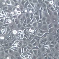 KYSE-30 细胞系、KYSE-30 细胞、KYSE-30 食管鳞癌细胞