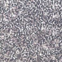 IMR-32细胞系、IMR32细胞、IMR-32神经母细胞瘤细胞