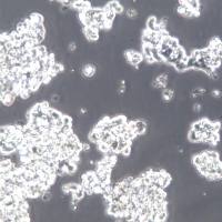 Y79细胞、Y79细胞系、Y79视网膜母细胞瘤细胞