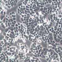 NCI-H460细胞株、NCI-H460细胞、NCI-H460大细胞肺癌细胞