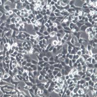 NCI-H157细胞系、NCI-H157细胞、NCI-H157非小细胞肺腺癌细胞