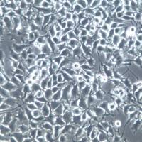 NCI-H3122细胞系、NCI-H3122细胞、NCI-H3122肺癌细胞