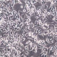 EBC-1细胞系、EBC-1细胞、EBC-1肺腺癌细胞