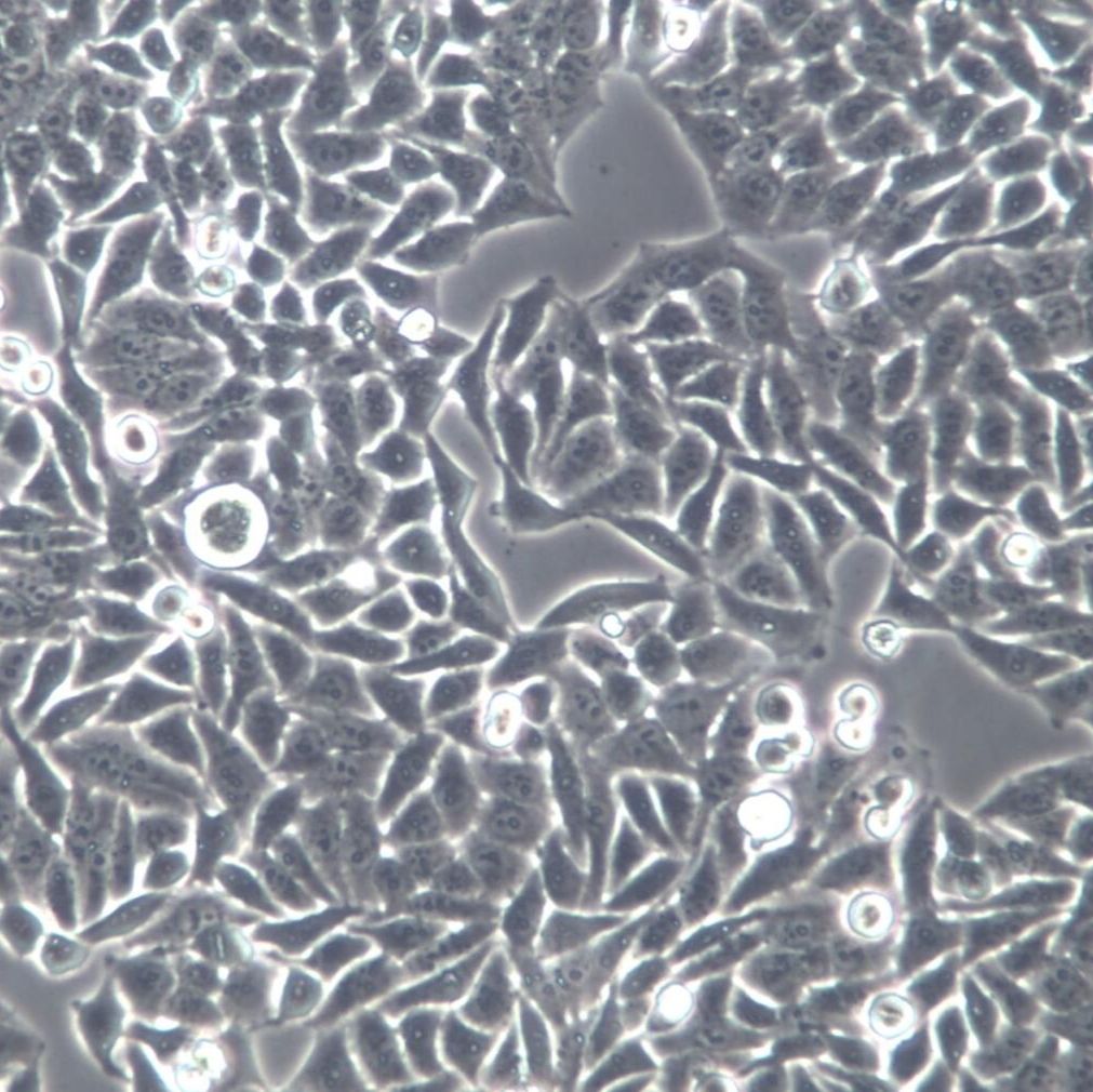 Hela细胞、Hela、Hela