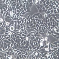 Hela细胞、Hela、Hela