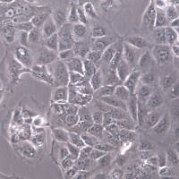 HuH-6细胞系、HuH6细胞、HuH-6肝母细胞瘤细胞