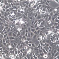 MS751细胞系、MS751细胞、MS751子宫颈表皮癌细胞