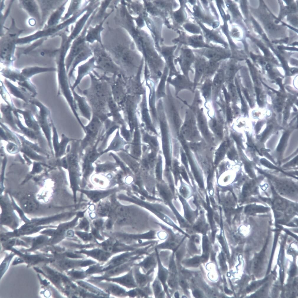 U-251 MG细胞系、U-251 MG细胞、U-251 MG星形胶质瘤细胞    通过STR鉴定