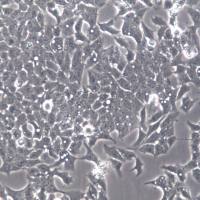 Ishikawa细胞系、Ishikawa细胞、Ishikawa子宫内膜癌细胞