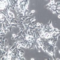 LS1034细胞、LS1034细胞系、LS1034结肠癌细胞