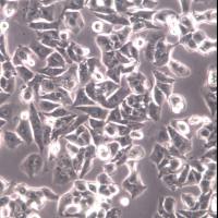 HCCLM3细胞系、HCCLM3细胞、HCCLM3高转移肝癌细胞