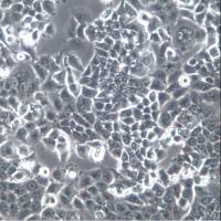 NCI-H2087细胞系、NCI-H2087细胞、NCI-H2087非小细胞肺腺癌细胞