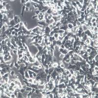 SNU-398细胞系、SNU-398细胞、SNU-398肝癌细胞