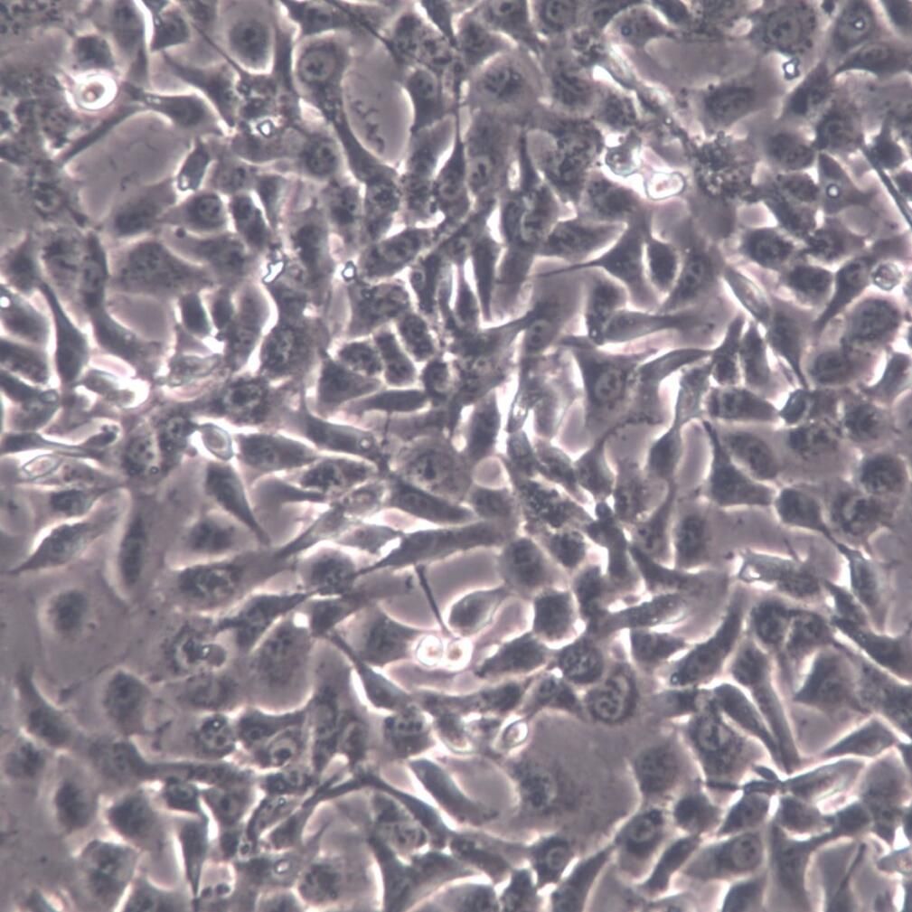 HT1080细胞系、HT1080细胞、HT1080纤维肉瘤细胞