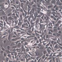 HT1080细胞系、HT1080细胞、HT1080纤维肉瘤细胞