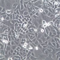 NCI-H522细胞株、NCI-H522细胞、NCI-H522非小细胞肺癌腺癌细胞