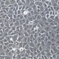 NP69细胞系、NP69细胞、NP69鼻咽上皮细胞