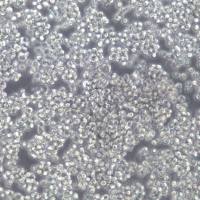 SU-DHL-10细胞株、SU-DHL-10细胞、SU-DHL-10弥漫大D细胞淋巴瘤