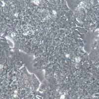 NCI-H2170细胞株、NCI-H2170细胞、NCI-H2170肺鳞癌细胞