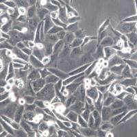 HCC95细胞系、HCC95细胞、HCC95肺腺癌细胞