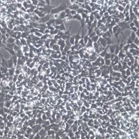 SK-N-MC 细胞、SK-N-MC 细胞系、SK-N-MC 神经上皮瘤细胞