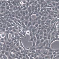 HBL-100细胞系、HBL-100细胞、HBL-100整合SV40基因的乳腺上皮细胞