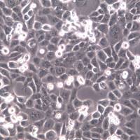 CAL-27细胞系、CAL-27细胞、CAL-27舌鳞癌细胞