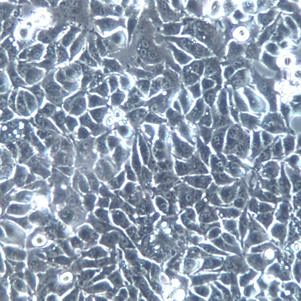 MHCC-97L 细胞株、MHCC-97L 细胞、MHCC-97L 肝癌细胞