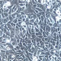 MHCC-97L 细胞株、MHCC-97L 细胞、MHCC-97L 肝癌细胞