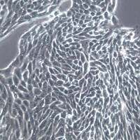 RMG-1细胞系、RMG-1细胞、RMG-1卵巢癌细胞