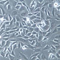 NCI-H1975细胞株、NCI-H1975细胞、NCI-H1975肺腺癌细胞