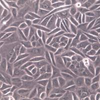 SiHa人子宫颈鳞状细胞癌细胞,SiHa细胞、SiHa