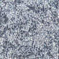 MIA paca-2细胞系、MIA paca-2细胞、MIA paca-2胰腺癌细胞