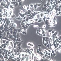 HEC-1-B细胞系、HEC-1-B细胞、HEC-1-B子宫内膜腺癌细胞