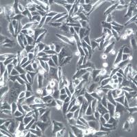 SW480细胞、SW480细胞株、SW480细胞系